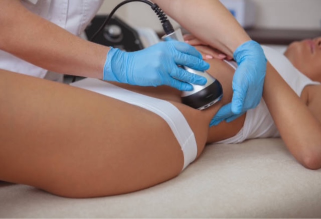 Lipocavitation & Radiofréquence