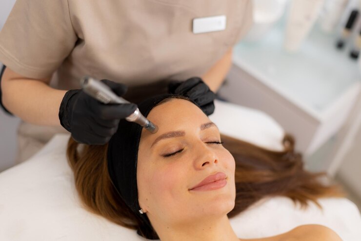 Microneedling